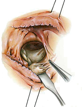 surgery 5